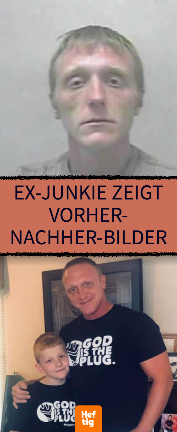 Ex-Junkie zeigt Vorher-nachher-Bilder