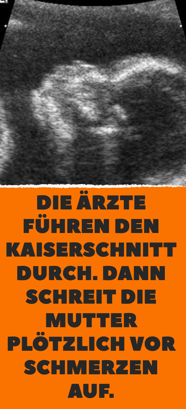 Die Ärzte führen den Kaiserschnitt durch. Dann schreit die Mutter plötzlich vor Schmerzen auf.