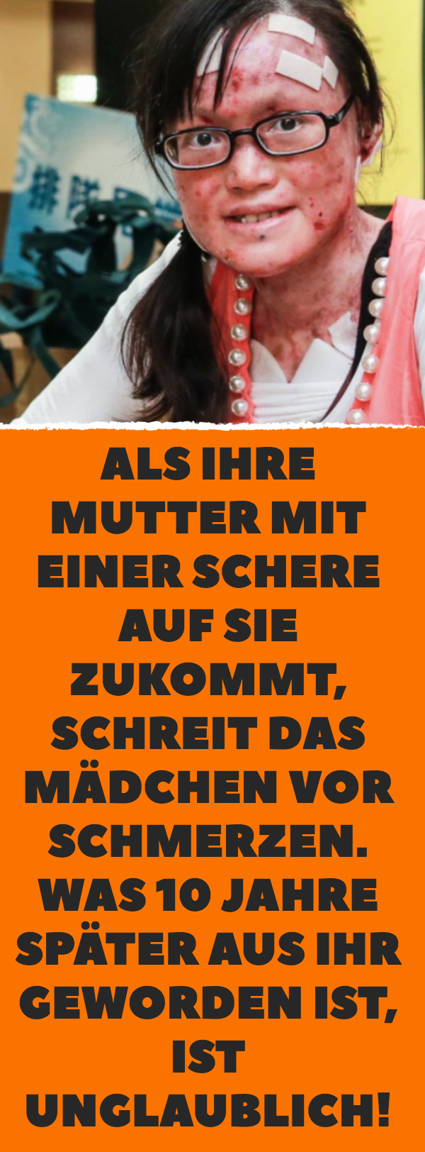 Als ihre Mutter mit einer Schere auf sie zukommt, schreit das Mädchen vor Schmerzen. Was 10 Jahre später aus ihr geworden ist, ist unglaublich!