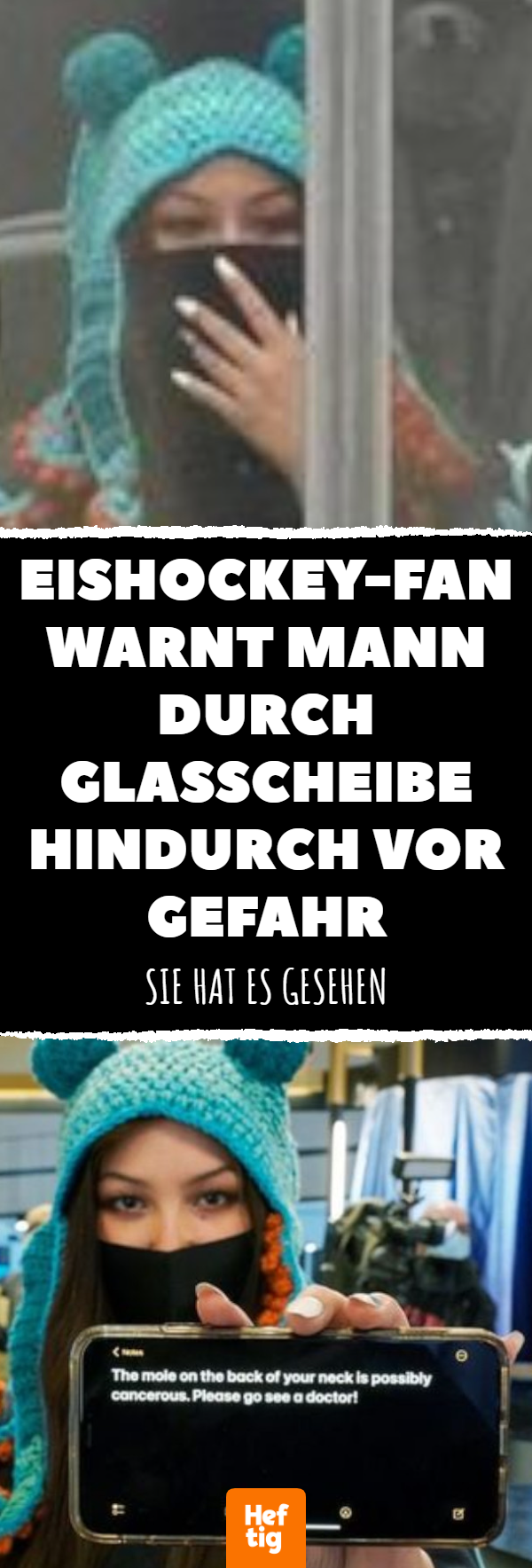 Eishockey-Fan warnt Mann vor gefährlichem Muttermal