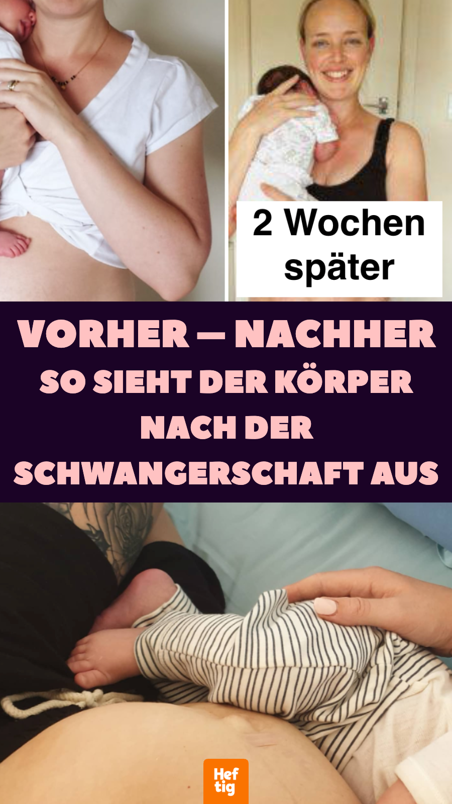 Vorher – nachher: Mutter teilt ehrliche Schwangerschaftsbilder